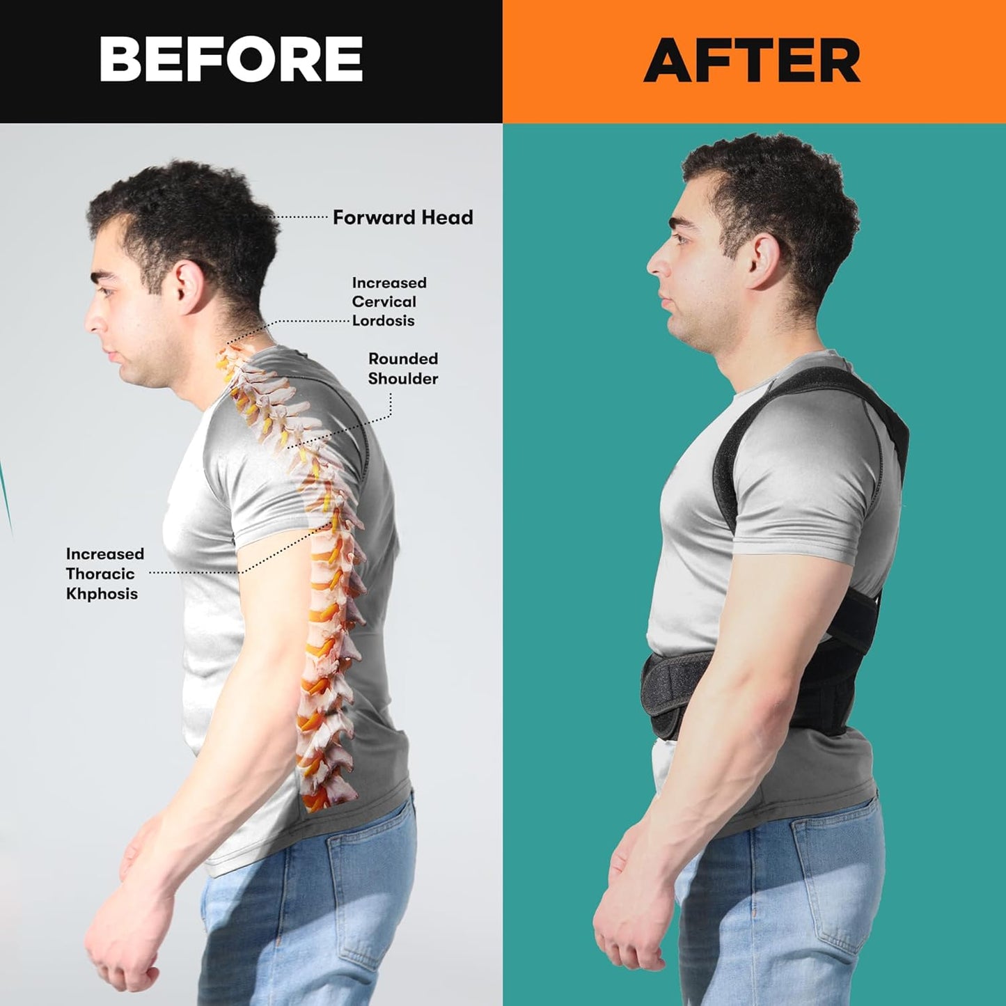 Posture Corrector - Adjustable Back Support